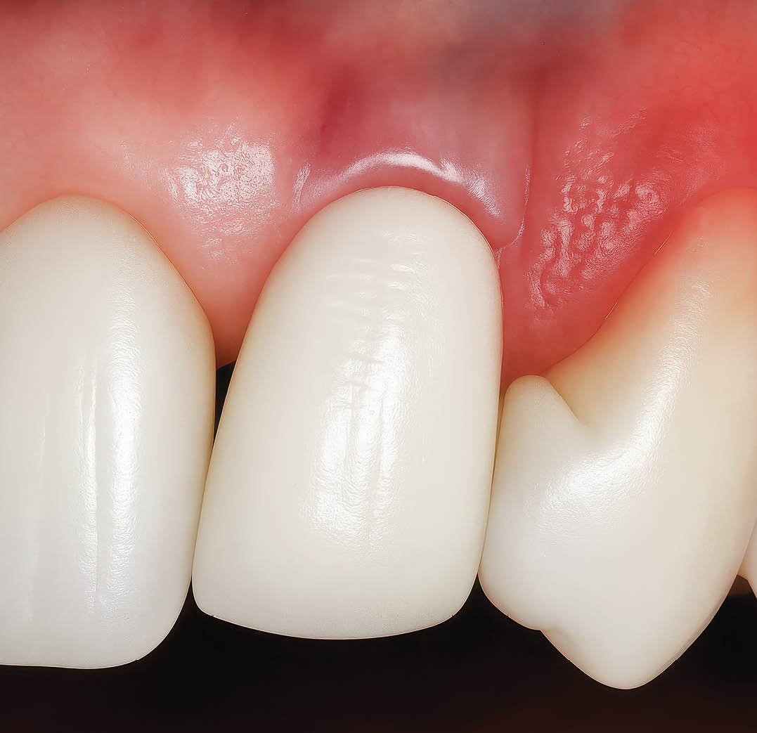 Upscaled with Gigapixel v1.0.2. 1024x1024 = 6144x6144 (6x) Model: Standard V2, denoise: 0.3962070914208889, sharpen: 0.2817015597820282, decompression: 0.01