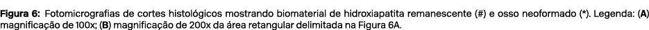 Figura 6: Fotomicrografias de cortes histol gicos mostrando biomaterial de hidroxiapatita remanescente (#) e osso neo...
