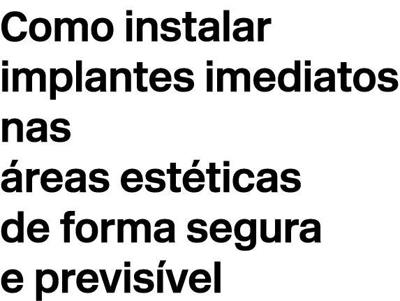 Como instalar implantes imediatos nas reas est ticas de forma segura e previs vel
